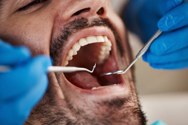 Best Broken or Cracked Tooth Emergency Dentist in Hewlett Harbor, NY