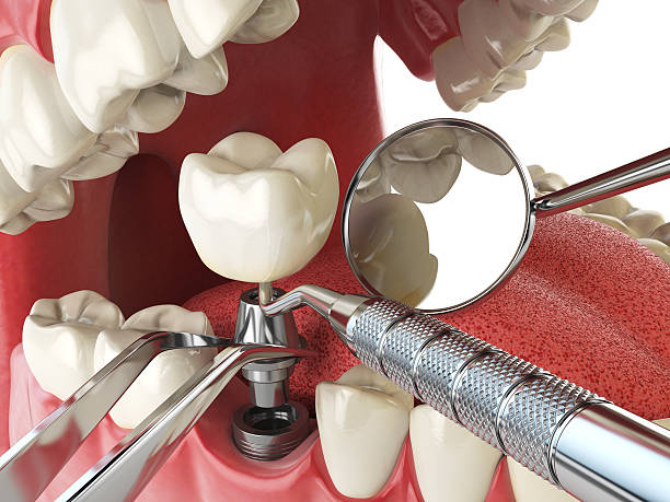Best Emergency Dental Services for Seniors in Hewlett Harbor, NY